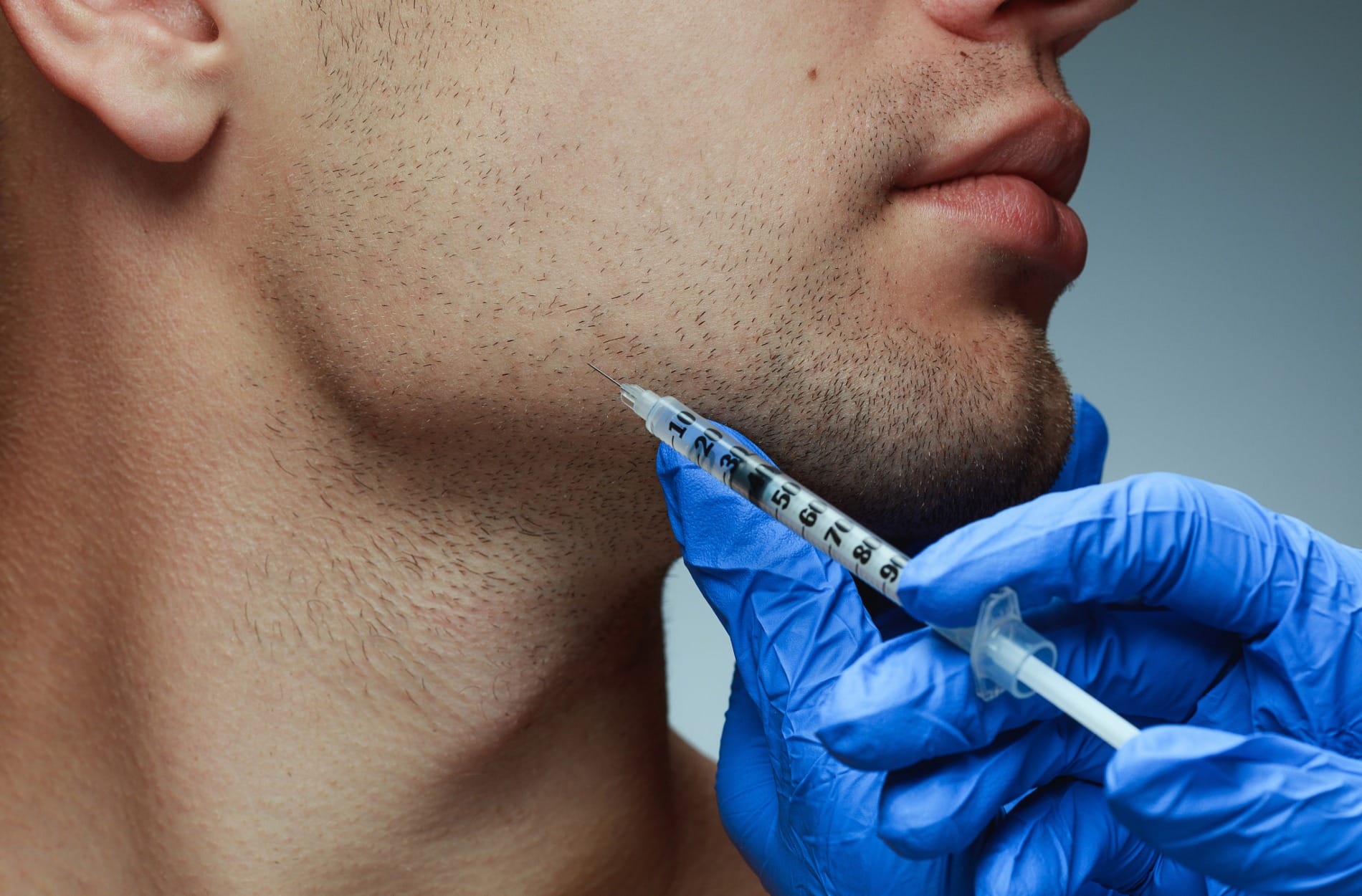 Why Botox Is Becoming Popular for Teeth Grinding Treatment
